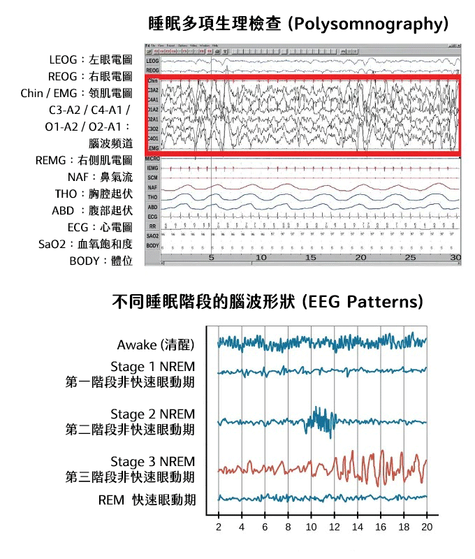 這張圖是睡眠多項生理檢查與不同睡眠階段的腦波形狀。醫學界幾十年來透過不同的生理檢查方式來觀察睡眠期間，人體的變化。這從科學與數據上給予睡眠更真實的觀察紀錄，同時證明大腦在睡眠期間並不是休眠狀態，而是另一種工作狀態。